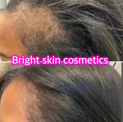 Hair growth oil