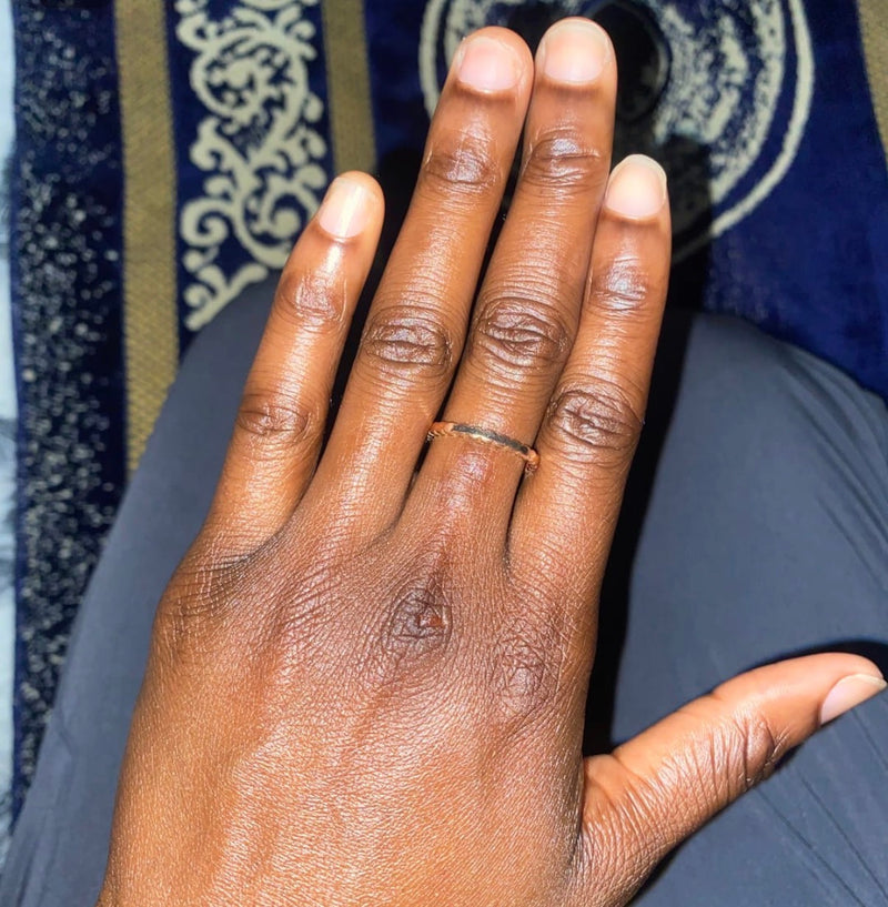 Uneven Skin Tone