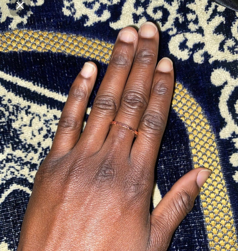 Uneven Skin Tone
